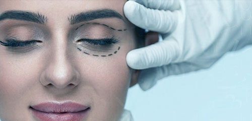 Blefaroplastia