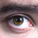 A obesidade na saúde ocular: quais os riscos?