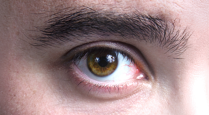 obesidade e a saúde ocular