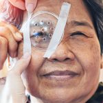 Os mitos e verdades sobre o transplante de córnea