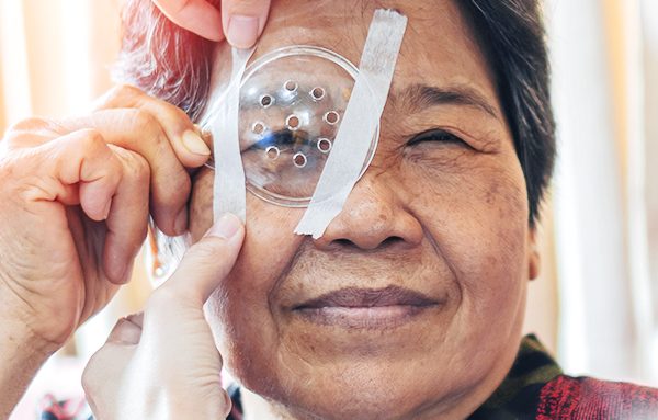 Os mitos e verdades sobre o transplante de córnea
